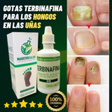 GOTAS ANTIMICOTICAS ELIMINA HONGOS (PIES Y MANOS )