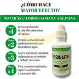 GOTAS ANTIMICOTICAS ELIMINA HONGOS (PIES Y MANOS )